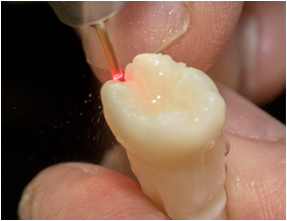 Servicespic03 | implant placement<br>and restoration