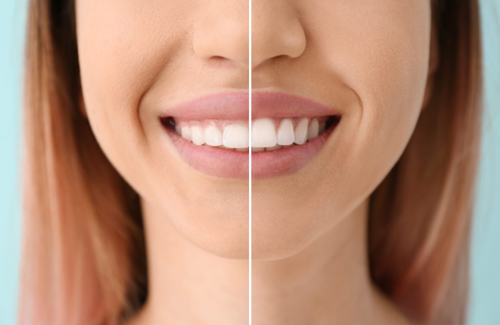 Rapid city sd dentist